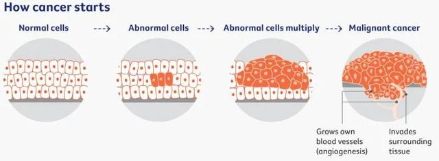 为什么癌症一发现就是晚期？-图1