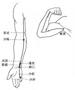 失眠分型论治