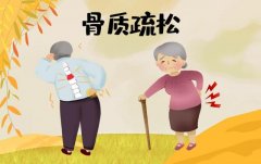 补肾抗衰系列谈——人老腿先老，骨骼衰老从3